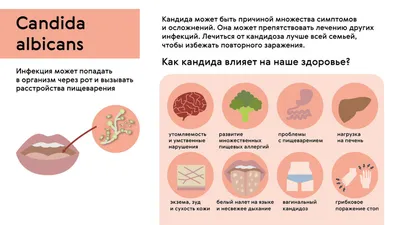 Как быстро избавиться от молочницы раз и навсегда - Как эффективно вылечить  молочницу женщин, мужчин, ребенка, при беременности