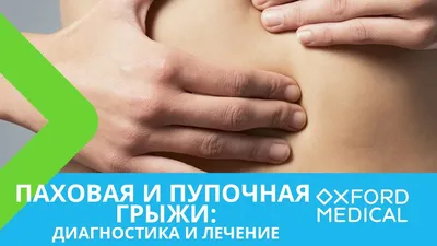 Паховая грыжа: причины, симптомы и хирургическое лечение в Москве в ФНКЦ  ФМБА