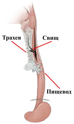 Cвищ На Десне 9 Фото От Зуба Прыщ Чем Полоскать ЛюмиДент