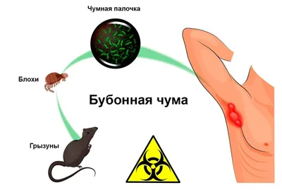 Чума: симптомы, формы, лечение