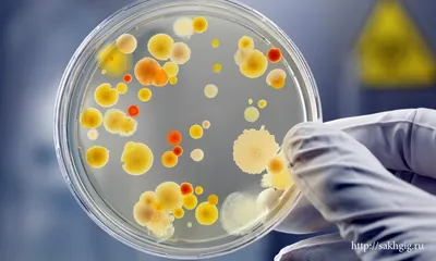 Чума́ (лат. pestis) — острое природно-очаговое инфекционное заболевание  группы карантинных инфекций - online presentation