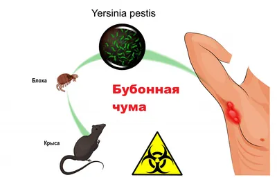 Чума - причины появления, симптомы заболевания, диагностика и способы  лечения