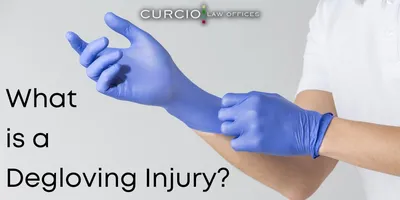 Degloving injury hi-res stock photography and images - Alamy