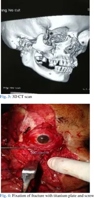 Right foot degloving injury condition – Medical Art Works