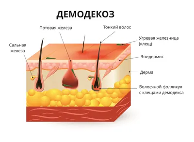 Демодекоз консультация лечение в Санкт-Петербурге медицинский центр  ID-CLINIC