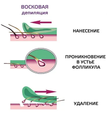 Депиляция воском