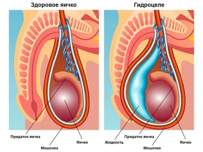 Дерматология - MEDUZAS