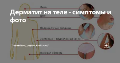 Экзема - причины и лечение в Санкт-Петербурге