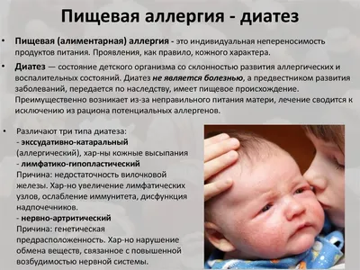 Аллергический диатез, или атопический дерматит👶 | Агуша - все о первом  прикорме | Дзен