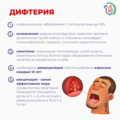 Легко перепутать с ангиной: инфекционист Мескина рассказала, что такое  дифтерия и чем она опасна | Вечерняя Москва | Дзен