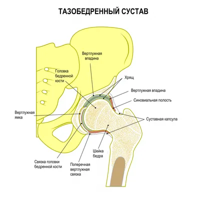 Лечение дисплазии тазобедренных суставов в СПб