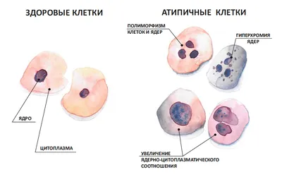 Нету складочки на одной ножке. Кто с таким сталкивался ? - Советчица