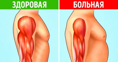 Сибирские ученые создали новое соединение для лечения мышечной дистрофии