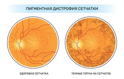 Лучевая диагностика миодистрофий в МедСевен