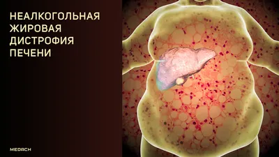 5 фактов о болезни Дюшенна, которые должны знать родители мальчиков - Центр  охраны материнства и детства г.Магнитогорск