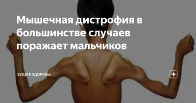 Мускулна дистрофия, тип Дюшен – Medical News