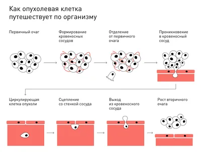 Презентация на тему: \"Доброкачественные новообразования челюстно-лицевой  области и шеи Выполнил студент: Бардин А.С. 506 гр. Инст. стом.\". Скачать  бесплатно и без регистрации.