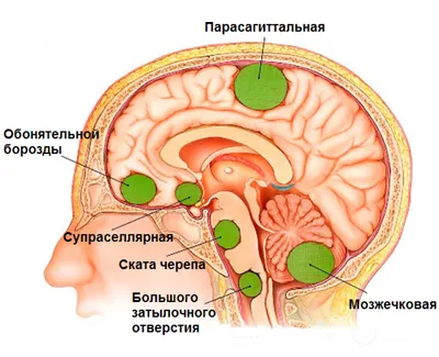 Гемангиома: симптомы, причины и виды, диагностика и методы лечения гемангиом