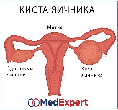 Диссертация на тему \"Структура врожденных опухолей у детей\", скачать  бесплатно автореферат по специальности 14.00.09 - Педиатрия