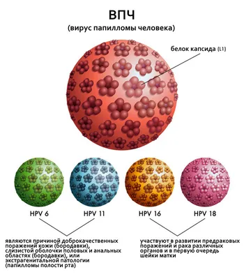 Папиллома это доброкачественное новообразование, возникающее на слизистых  оболочках и коже.