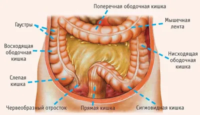 Осложнения при Долихосигме. Хронические запоры. Клиника в Ростове-на-Дону -  Doctor-Prof