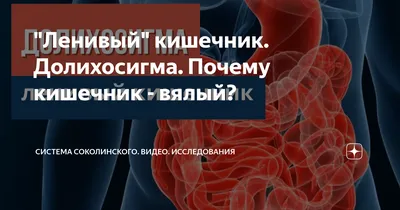 Что такое резекция сигмовидной кишки и когда она проводится