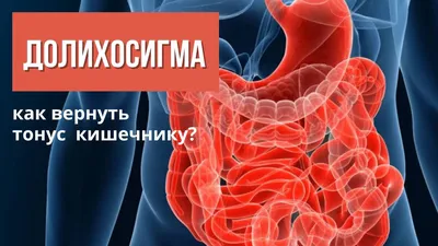 Ленивый\" кишечник. Долихосигма. Почему кишечник - вялый? | Система доктора  Соколинского. Видео. Исследования | Дзен