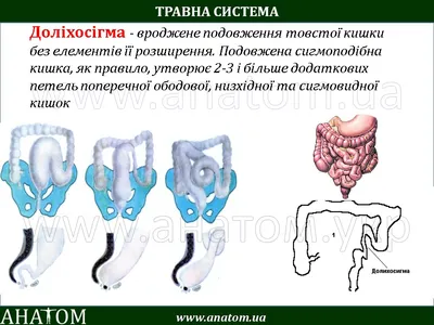 Причина неполного опорожнения ? Долихосигма ? | Портал радиологов