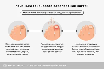 Грибок ногтей — причины, симптомы и способы лечения | Клиника Биляка