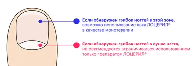 Грибок кожи, ногтей, складок | Центр подологии и остеопатии Татьяны Красюк