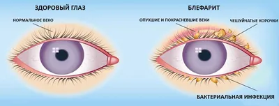 Грибковые заболевания, как уберечься? Блог ОН Клиник