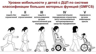 Как заметить симптомы ДЦП у новорожденного? Интервью с реабилитологом.🔆 |  Центр нейрореабилитации BRT | Дзен