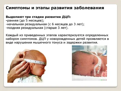 6 признаков ДЦП у ребенка с рождения и до 1,5 лет.👀 | Центр  нейрореабилитации BRT | Дзен