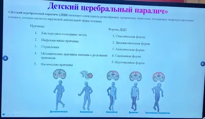 6 признаков ДЦП у ребенка с рождения и до 1,5 лет.👀 | Центр  нейрореабилитации BRT | Дзен