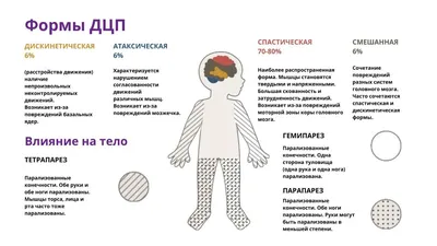 Встать на ноги детям с ДЦП помогают нейрохирурги » ФГБУ «НМИЦ им. В. А.  Алмазова» Минздрава России