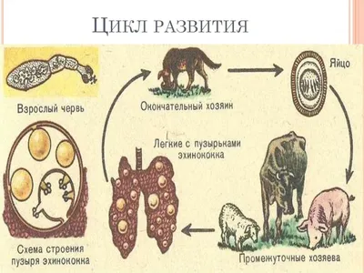 УЗИ диагностика эхинококка печени осложненного кровоизлиянием в полость  кисты