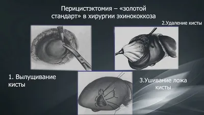 Чужие против хищника: чем именно опасны эхинококки | Статьи | Известия