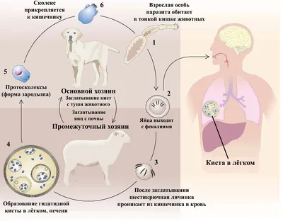 Эхинококкоз. Симптомы и лечение в Ташкенте в клинике Urologic Complex