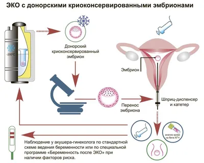 Экстракорпоральное оплодотворение (ЭКО) в Киеве | ЭКО - Цена, программы |  ICSI клиника