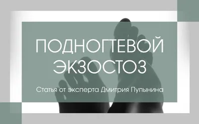 Подногтевой экзостоз лечение в Перми | Консультация ортопеда