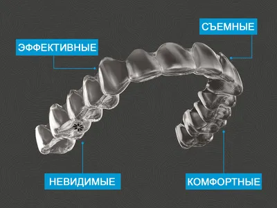 1️⃣ Элайнеры Алматы | Клиника «Dental Center»