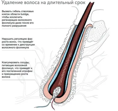 Электроэпиляция бровей в Москве - центр Вселенная красоты