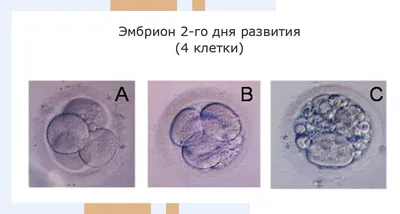 Развитие эмбриона по дням после ЭКО: стадии развития после переноса, рост,  таблицы норм