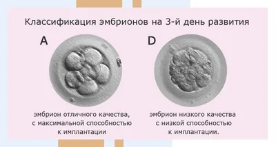 Какие эмбрионы переносить? 3-х дневные или 5-ти дневные эмбрионы