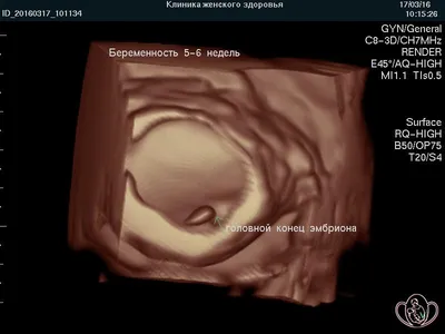 Почему перенос эмбриона лучше делать именно на 5-й день развития? —  Reprolife