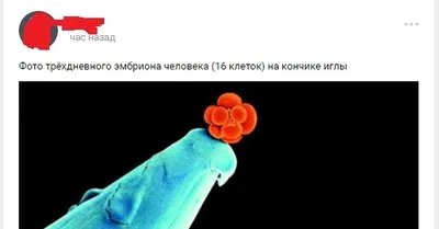 К вопросу о понятии и правовом положении эмбриона человека – тема научной  статьи по праву читайте бесплатно текст научно-исследовательской работы в  электронной библиотеке КиберЛенинка