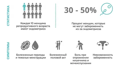 Эндометриоз - причины, симптомы, диагностика, лечение и профилактика