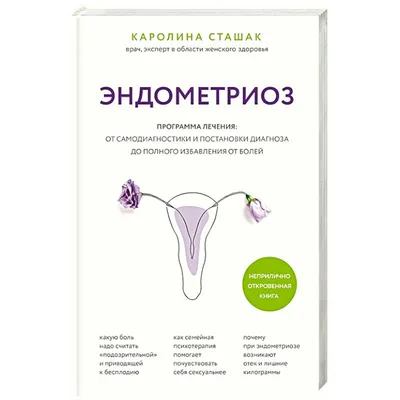 Эндометриоз: чем он опасен и как его лечить? | ПульсПлюс | Дзен