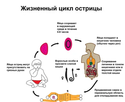 Энтеробиоз - причины появления, симптомы заболевания, диагностика и способы  лечения