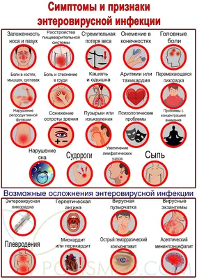 Энтеровирусная инфекция. Причины, симптомы, диагностика и лечение  заболевания. | ЧУЗ \"РЖД-Медицина\" г. Выборг\"